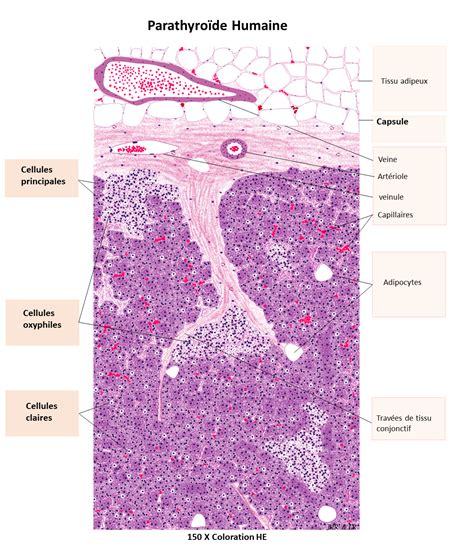 histologie de adenom paratiroidic criză de hipercalcemie